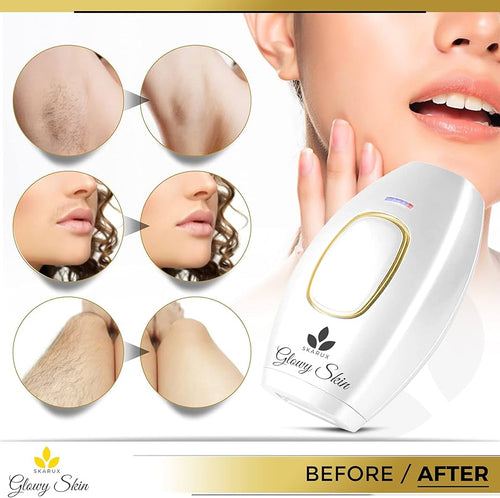 Mini Laser Hair Removal